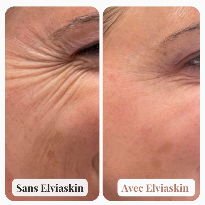 Masque Liftant au Collagène Elviaskin - elviaskin.fr